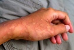 NHC shows a report of severe diseases prevailing in India.