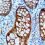 Advancement of Galectin-3 Inhibitors Is Being Pursued