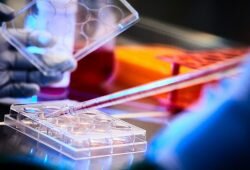 In a share purchase agreement with Xinteza API Ltd, IM Cannabis Corp has invested in a unique biosynthesis technology