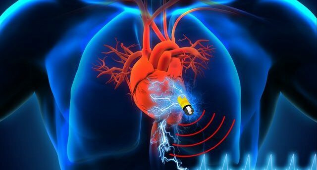 Active Implantable Medical Devices
