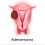 Recent Advancements in Adenomyosis Treatment Market by 2019-2026 Focusing on Leading Players – Bayer AG, Ferring B.V, Johnson & Johnson, Novartis, Merck, Pfizer