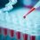 Sky Rocketing Growth of Blood Virus Testing Market Trends, Business Outlook 2020, Expanding Current Industry Status by Top Most Players: bioMerieux, Bio-Rad Laboratories, Thermo Fisher Scientific
