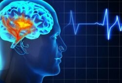 Brain Monitoring Devices