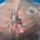 Cardiac Defibrillators Market By Top Keyplayers Medtronic, St