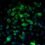 Catenin Beta 1 Market By Top Keyplayers Boston Biomedical Inc, Dicerna Pharmaceuticals Inc, Marina Biotech Inc, Propanac Biopharma Inc, Warp Drive Bio Inc