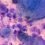 Cytomegalovirus (HHV-5) Infection Therapeutic Drugs Market Is Booming Across the Globe Explored in Latest Report 2020-2027 | Analysis by Key Players Chimerix, Novartis, 3 V Biosciences, Applied Immune, Vakzine Projekt Management, AlphaVax