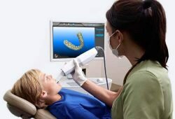 Digital Dental Impressions