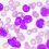 Enasidenib Drugs Market Global Industry Trends, Share, Size and Forecast Report By 2025 |Celgene Corporation