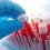 Hematology Analyzer and Reagent Market to Witness Tremendous Growth in Forecasted Period 2020-2027