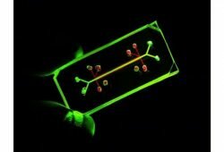 Kidney-on-a-chip Market
