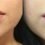 Lip Augmentation Market is Expected to Grow at a Healthy CAGR by 2027 |Allergan, Laboratories Vivacy, Sinclair Pharma