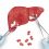 Liver Cancer Treatment Drugs Market is thriving worldwide by 2027 | Top Key Players like Eisai, Exelixis, Onyx Pharmaceuticals Inc, Alnylam Pharmaceuticals, Inc, Pfizer Inc, F. Hoffmann-La Roche Ltd.