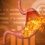 Peptic Ulcers Treatment Market With Impact Of Covid 19 By Top Key Players Ache Laboratorios Farmaceuticos S/A, Astellas Pharma Inc