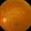 Rising Demand for Retinitis Pigmentosa Treatment Market Forecast by 2027 With Top Key profiles: ReNeuron Group plc, Amarantus BioScience Holdings Inc., Ocugen Inc.