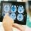 Traumatic Brain Injury Diagnostic Market Is Set for a Rapid Growth and is Expected to Reach USD Billion by 2027 | Top Companies- ABCDx, Banyan, Quanterix, Medicortex, BioDirection