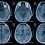 Traumatic Brain Injury Diagnostic Market by Analysis, Trends, Growth, Size and Forecast 2020-2027