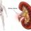 As Per New Study Report on Kidney Stone Therapy Market Set to Grow Significantly in Upcoming Years Forecast by 2027| Key Players like Direx Group, Walz Elektronik, GEMSS Co, Inceler Medikal, Richard Wolf, EMS Electro Medical Systems